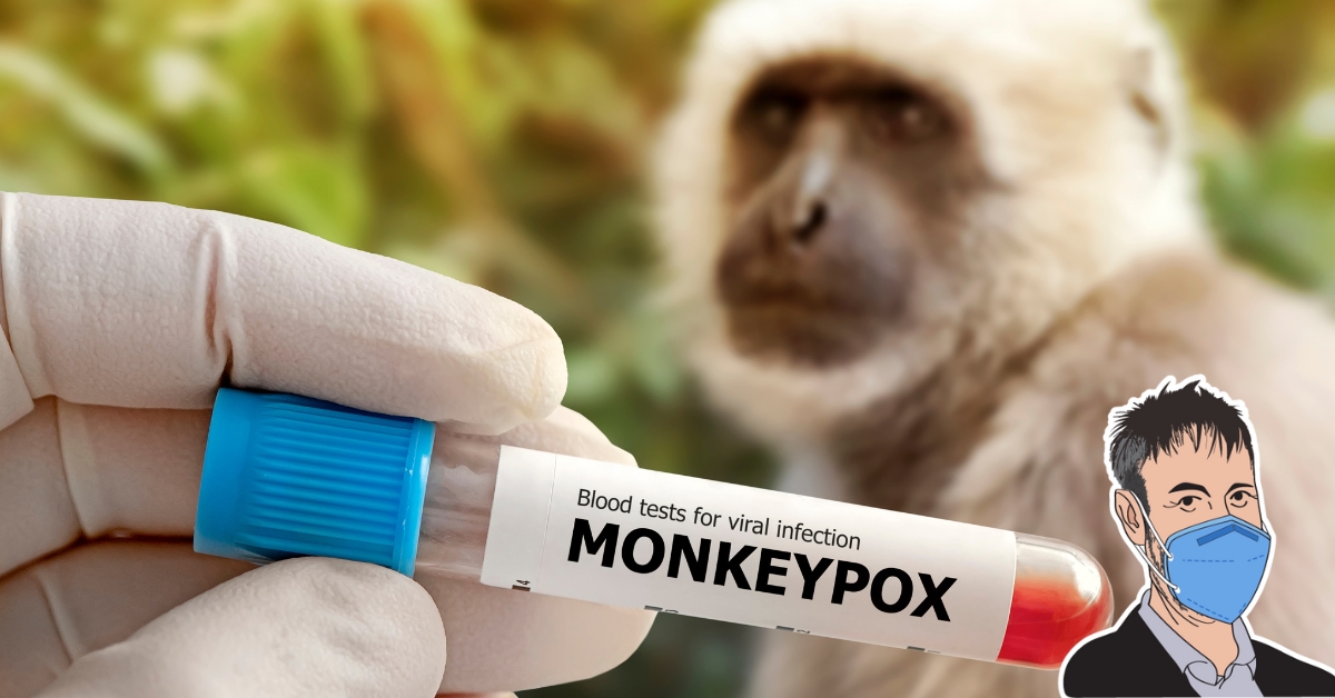 Kiasi About Mpox? No Monkey Business With Seniors, Masks And Virus Scares